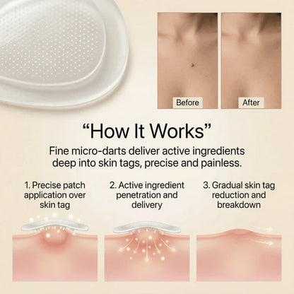 DermaSmooth Skin - Tag Remover Patch